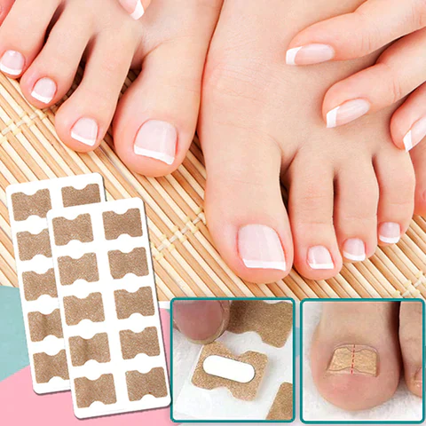 Nzmarket™ Corrective Patches for Ingrown & Curved Nails