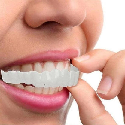 Nzmarket Snap-On Veneers – Top & Bottom Set Included
