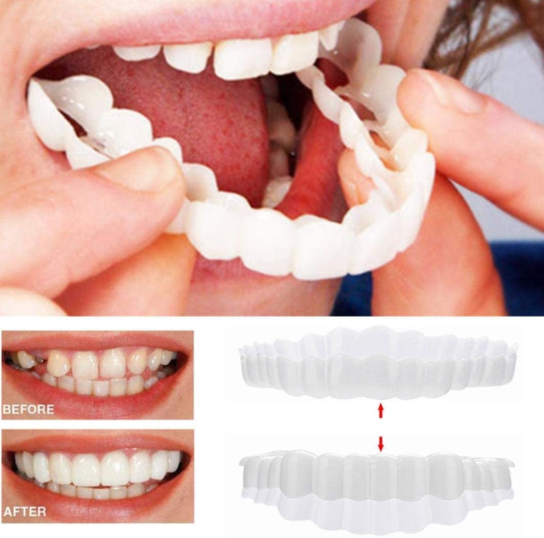Nzmarket Snap-On Veneers – Top & Bottom Set Included