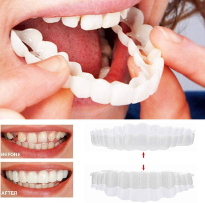 Nzmarket Snap-On Veneers – Top & Bottom Set Included