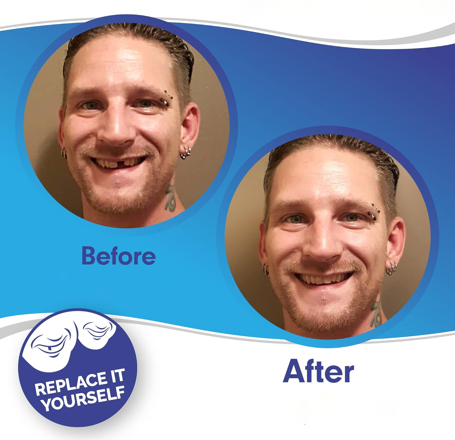 Nzmarket Snap-On Veneers – Top & Bottom Set Included