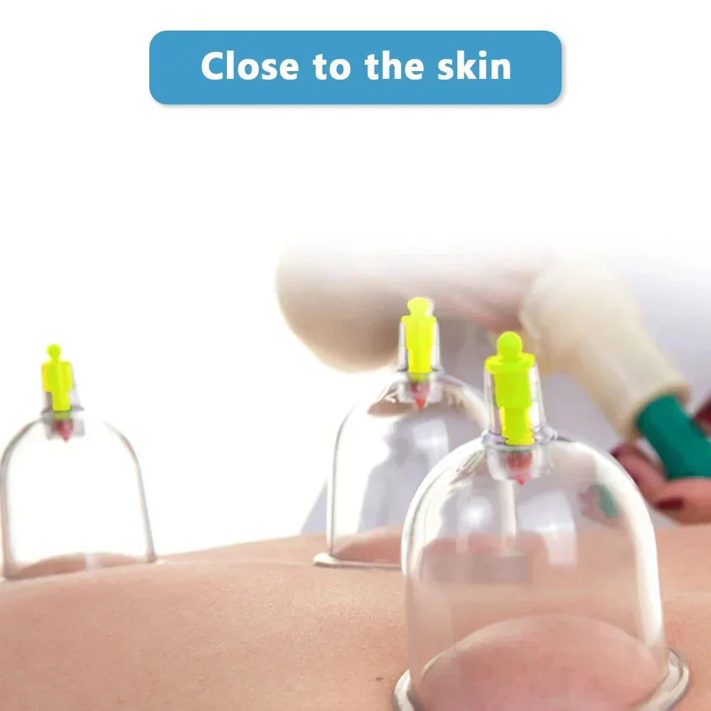 32-Glass Vacuum Cupping Set - Full Body Massage Kit