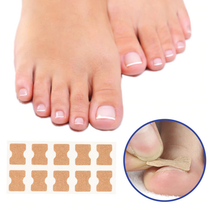 Nzmarket Corrective Patches for Ingrown & Curved Nails