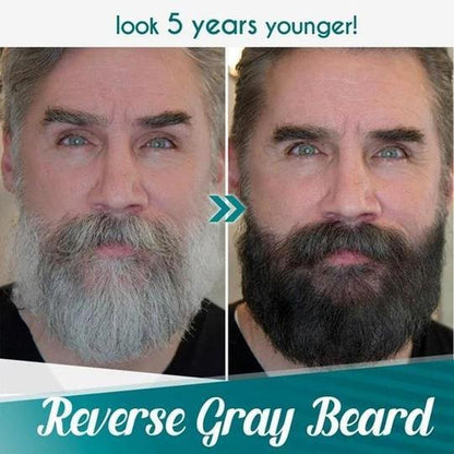 Nzmarket Waterproof Beard Filling Pen Kit – Fuller, Defined Beard Instantly