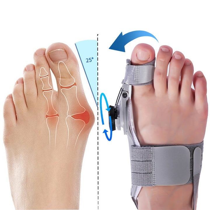 BunionEase Bunion Fix Corrector