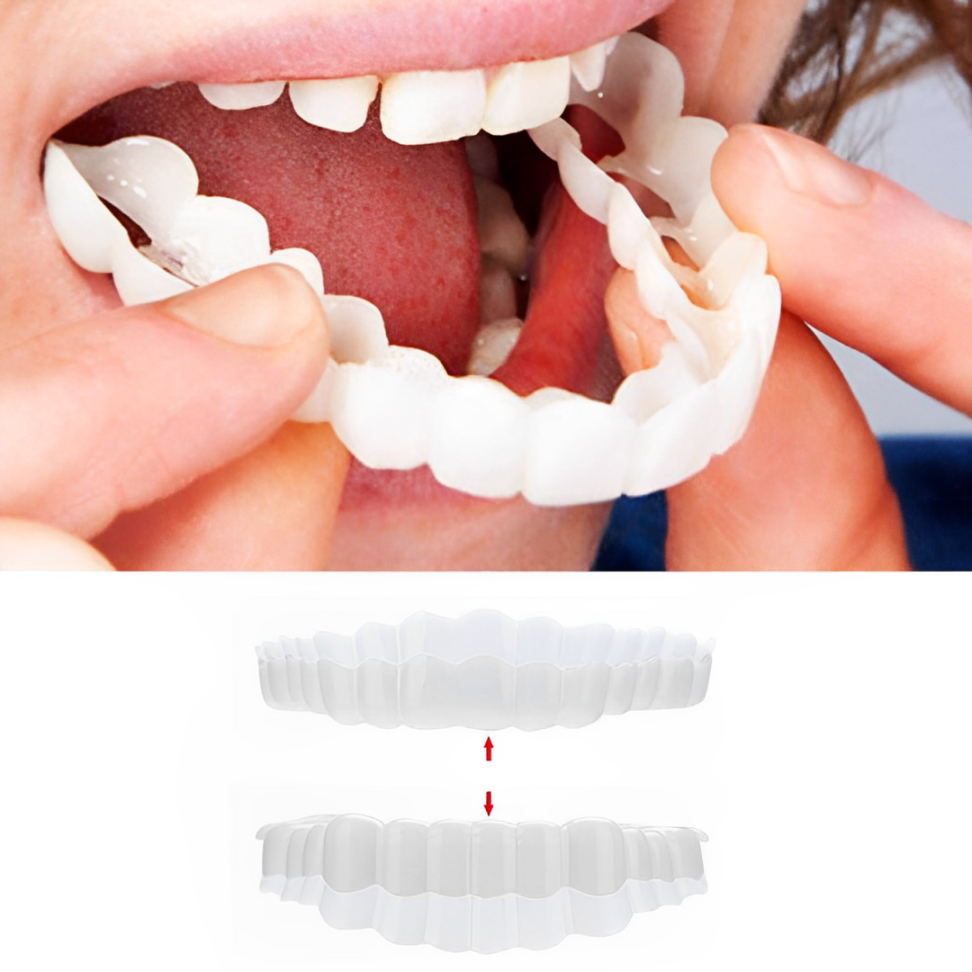 Nzmarket Snap-On Veneers – Top & Bottom Set Included