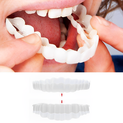 Nzmarket Snap-On Veneers – Top & Bottom Set Included