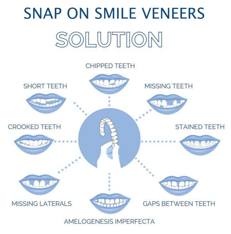 Nzmarket Snap-On Veneers – Top & Bottom Set Included