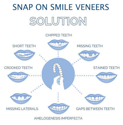 Nzmarket Snap-On Veneers – Top & Bottom Set Included