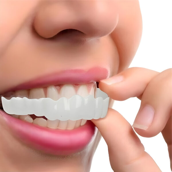 Nzmarket Snap-On Veneers – Top & Bottom Set Included
