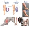 ComfortFlow Support Socks | Highly Elastic Calf Compression